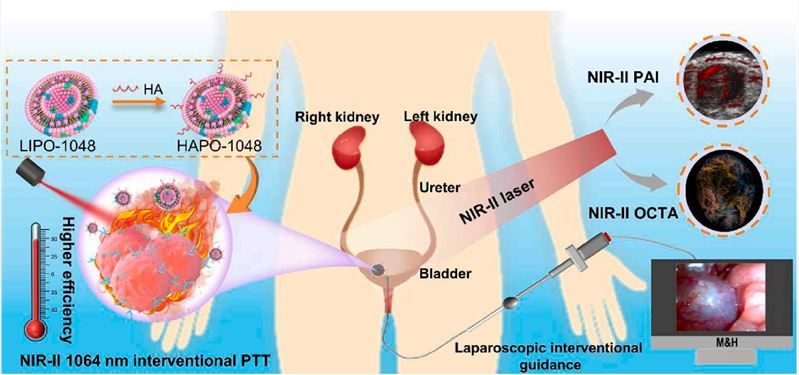 Fig 1. Schematic representation of NIR-II optical imaging and non-invasive interventional photothermal therapy for bladder cancer. (Hong F., et al. 2022)