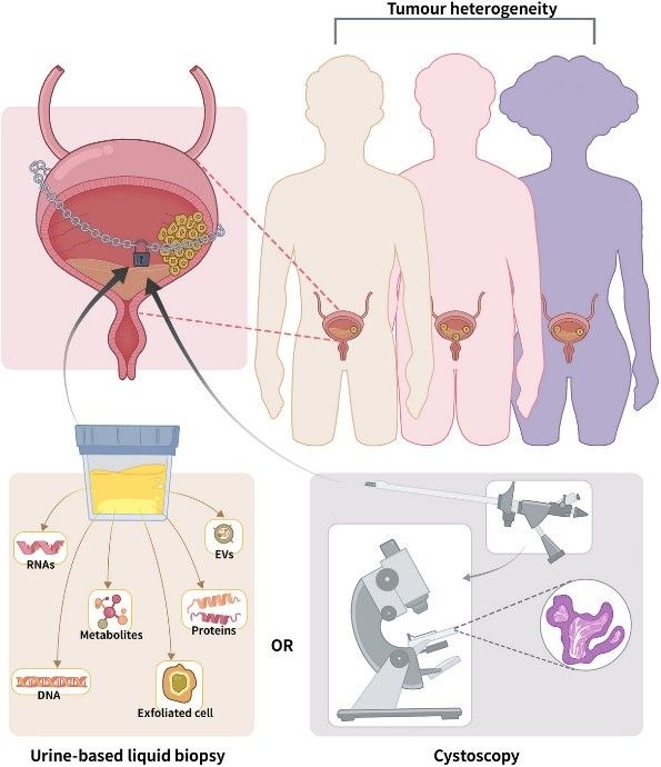 Fig.1 Urine-derived biomarkers for the diagnosis of bladder cancer.