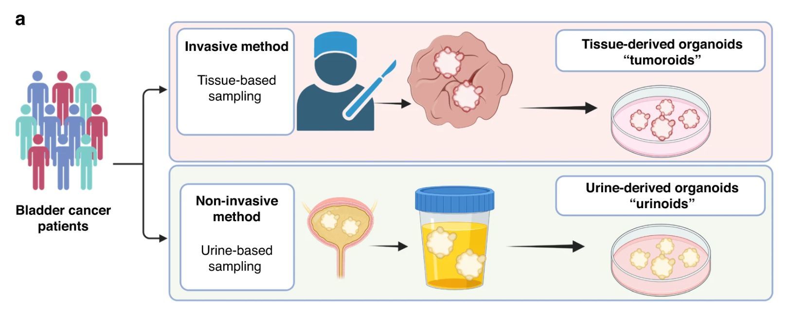Fig.1 Schematic representation of non-invasive organoid sampling for bladder cancer patient stratification. (Viergever B. J., et al. 2024)