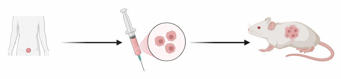Fig.1 Patient-Derived Xenograft (PDX) Model.