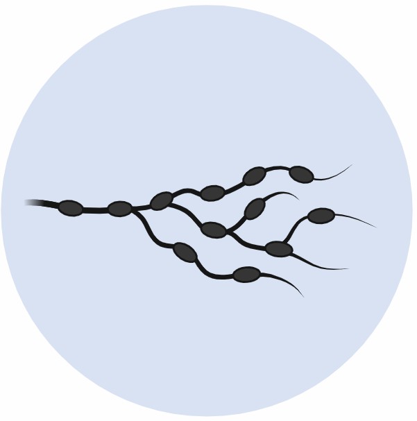 Fig 2. Mechanism Study Service for Lymph Node Metastatic Bladder Cancer