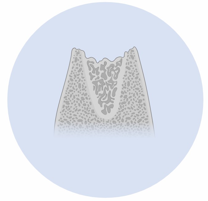 Fig 5. Mechanism Study Service for Bone Metastatic Bladder Cancer.