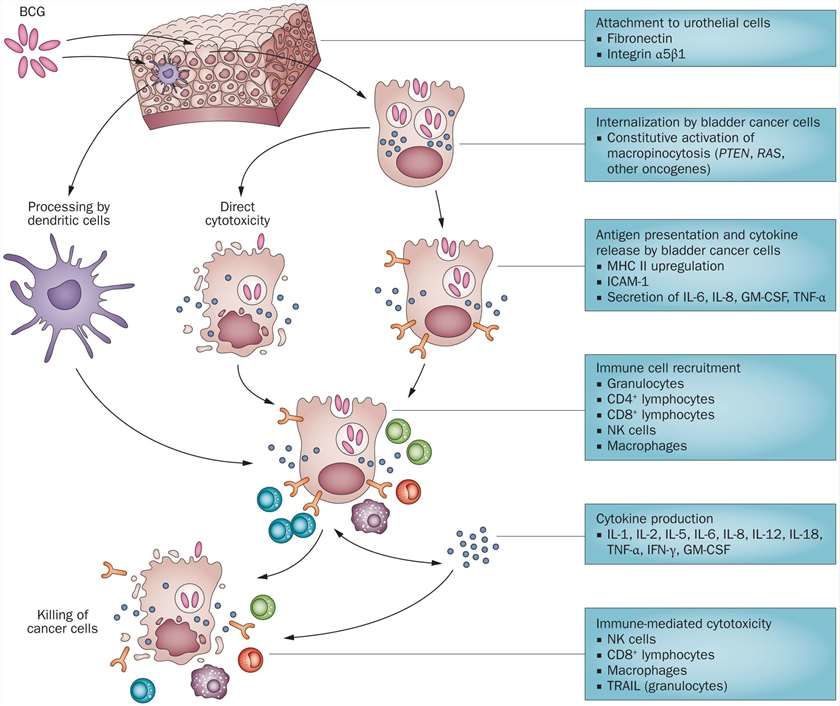 Fig.1 The mechanism of action of BCG therapy for bladder cancer.