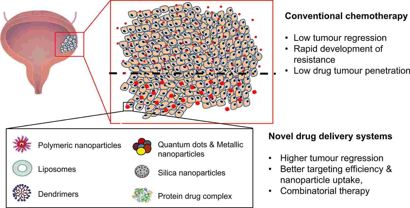 Fig 1. Therapies and nano drug delivery systems for bladder cancer. (Choi H., et al. 2020)