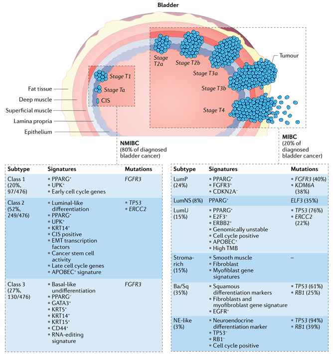 Fig.1 Molecular subtypes of muscle-invasive bladder cancer with associated clinicopathologic and genomic characteristics.